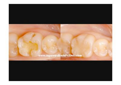 direct bonding page007.jpg